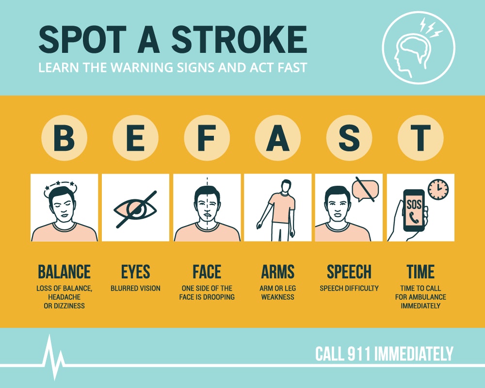 stroke symptoms face