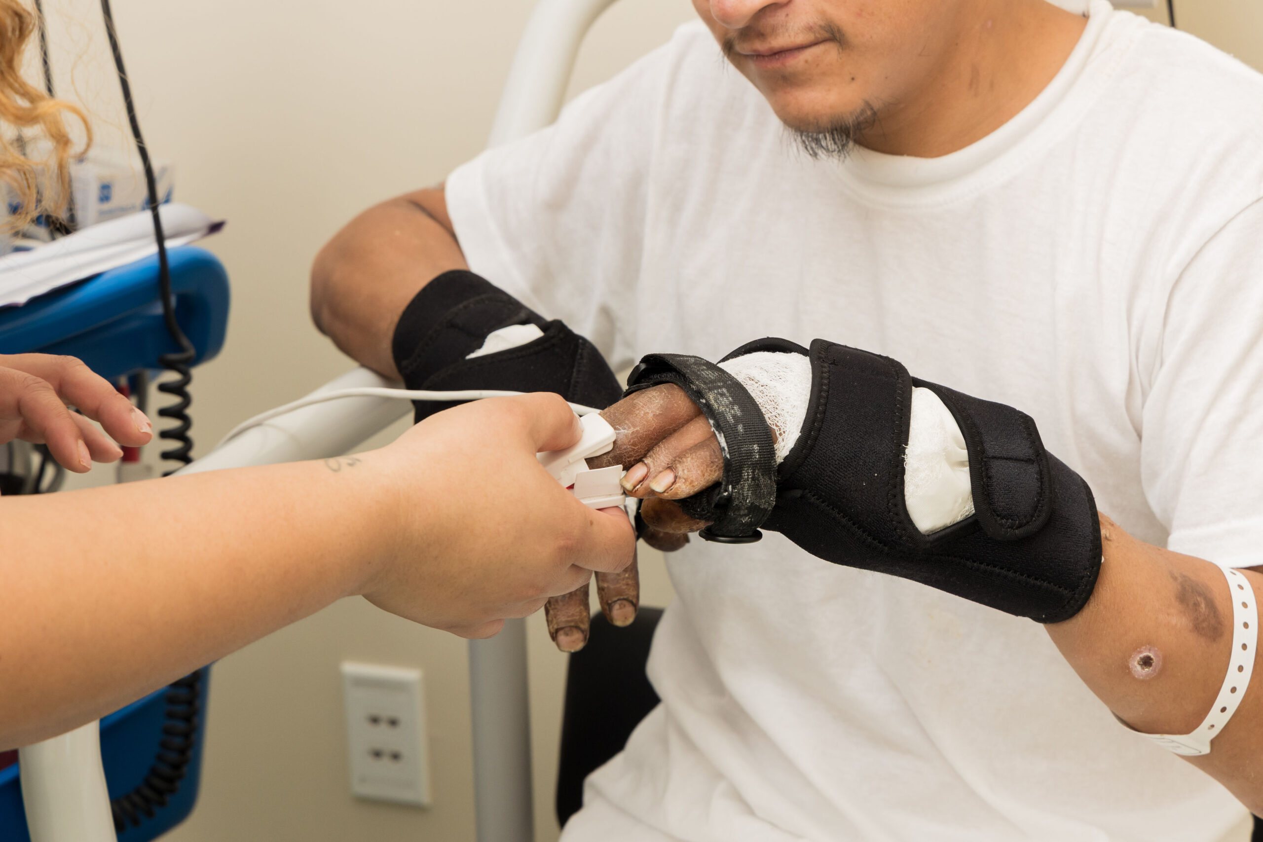 Patient with bandgaes on hands getting finger temperature.
