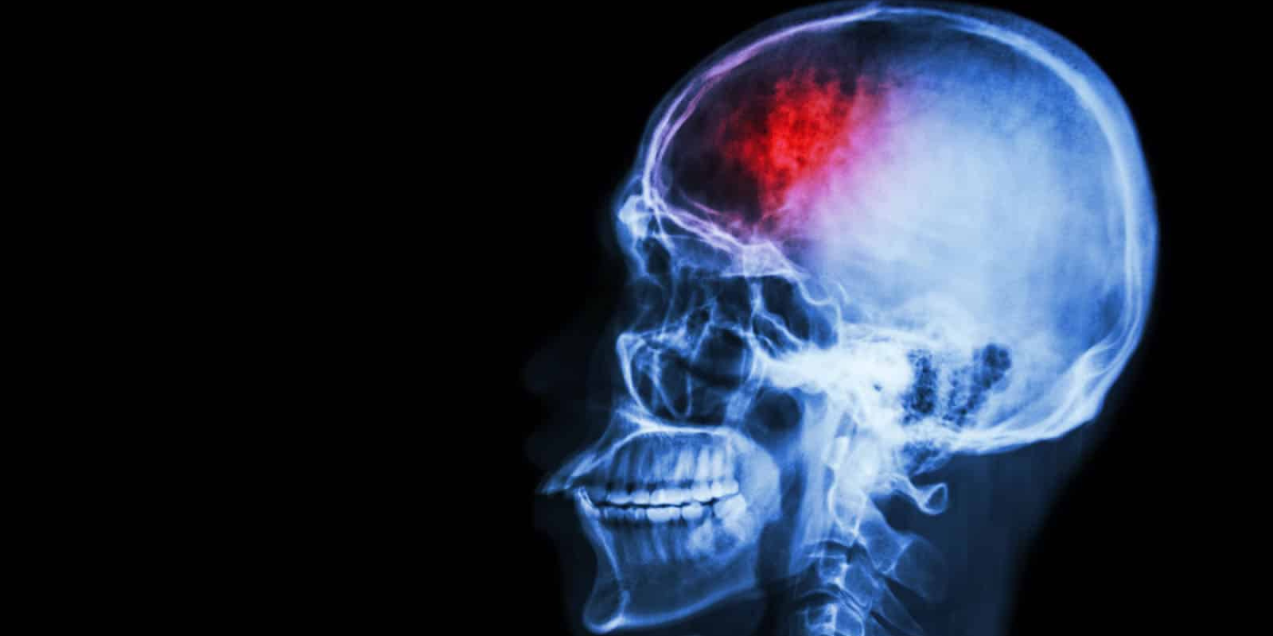May is Stroke Awareness Month-Banner